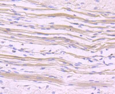 Immunohistochemistry-Paraffin: NFATC1/NFAT2 Antibody (JA81-03) [NBP2-66973] - Analysis of paraffin-embedded human skeleton muscle tissue using anti-NFAT2 antibody. Counter stained with hematoxylin.