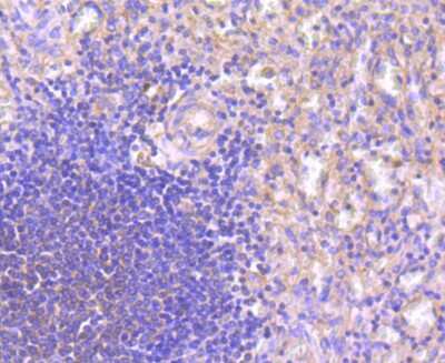 Immunohistochemistry-Paraffin: NFATC1/NFAT2 Antibody (JA81-03) [NBP2-66973] - Analysis of paraffin-embedded human spleen tissue using anti-NFAT2 antibody. Counter stained with hematoxylin.