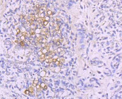 Immunohistochemistry-Paraffin: NFATC1/NFAT2 Antibody (JA81-03) [NBP2-66973] - Analysis of paraffin-embedded human thymus tissue using anti-NFAT2 antibody. Counter stained with hematoxylin.