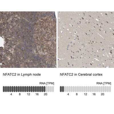 <b>Orthogonal Strategies Validation. </b>Immunohistochemistry-Paraffin: NFATC2/NFAT1 Antibody [NBP1-82582] - Staining in human lymph node and cerebral cortex tissues using anti-NFATC2 antibody. Corresponding NFATC2 RNA-seq data are presented for the same tissues.