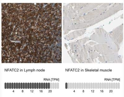 Immunohistochemistry-Paraffin NFATC2/NFAT1 Antibody