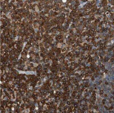 Immunohistochemistry-Paraffin: NFATC2/NFAT1 Antibody [NBP1-82583] - Staining of human lymph node shows positivity in lymphoid cells.