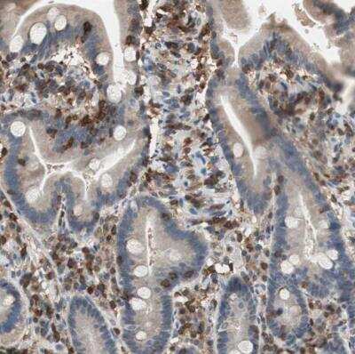 Immunohistochemistry-Paraffin: NFATC2/NFAT1 Antibody [NBP1-82583] - Staining of human duodenum shows positivity in lymphoid cells.