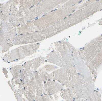 Immunohistochemistry-Paraffin: NFATC2/NFAT1 Antibody [NBP1-82583] - Staining of human skeletal muscle shows no positivity in myocytes as expected.