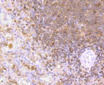 Immunohistochemistry-Paraffin: NFATC2/NFAT1 Antibody (JA11-08) [NBP2-66974] - Analysis of paraffin-embedded human spleen tissue using anti-NFAT1 antibody. Counter stained with hematoxylin.