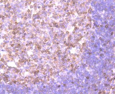 Immunohistochemistry-Paraffin: NFATC2/NFAT1 Antibody (JA11-08) [NBP2-66974] - Analysis of paraffin-embedded human tonsil tissue using anti-NFAT1 antibody. Counter stained with hematoxylin.