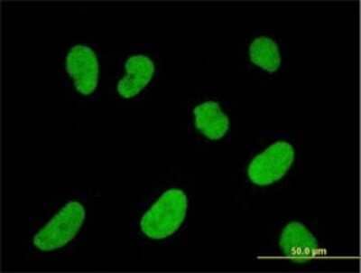 Immunocytochemistry/Immunofluorescence: NFATC2IP Antibody (2D7-A10) [H00084901-M01] - Analysis of monoclonal antibody to NFATC2IP on HeLa cell . Antibody concentration 10 ug/ml.