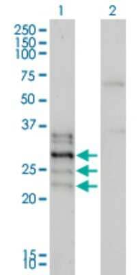 Western Blot: NFATC2IP Antibody (2D7-A10) [H00084901-M01] - Analysis of NFATC2IP expression in transfected 293T cell line by NFATC2IP monoclonal antibody (M01), clone 2D7-A10.Lane 1: NFATC2IP transfected lysate(15 KDa).Lane 2: Non-transfected lysate.