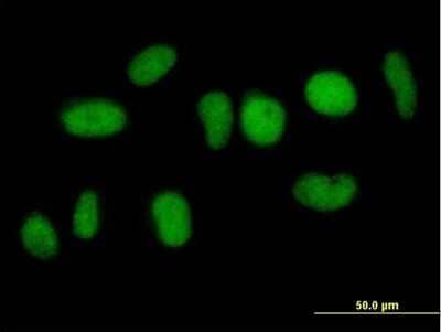 Immunocytochemistry/Immunofluorescence: NFATC2IP Antibody [H00084901-B01P] - Analysis of purified antibody to NFATC2IP on HeLa cell. (antibody concentration 10 ug/ml)