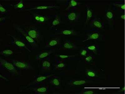 Immunocytochemistry/Immunofluorescence: NFATC2IP Antibody [H00084901-D01P] - Analysis of antibody to NFATC2IP on HeLa cell. Antibody concentration 10 ug/ml.