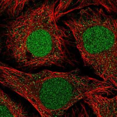 Immunocytochemistry/Immunofluorescence: NFATC2IP Antibody [NBP2-58210] - Staining of human cell line HeLa shows localization to nucleus.