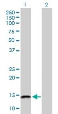 Western Blot: NFATC2IP Antibody [H00084901-D01P] - Analysis of NFATC2IP expression in transfected 293T cell line by NFATC2IP polyclonal antibody.Lane 1: NFATC2IP transfected lysate(15.10 KDa).Lane 2: Non-transfected lysate.