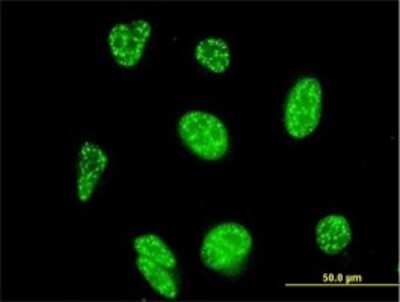 Immunocytochemistry/ Immunofluorescence NFATC3/NFAT4 Antibody (3A12) - Azide and BSA Free