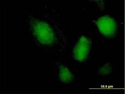 Immunocytochemistry/Immunofluorescence: NFATC3/NFAT4 Antibody [H00004775-B01P] - Analysis of purified antibody to NFATC3 on HeLa cell. (antibody concentration 10 ug/ml)