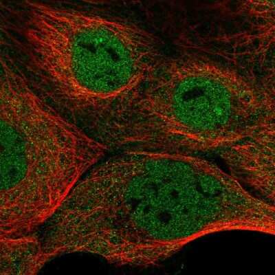 Immunocytochemistry/Immunofluorescence: NFATC3/NFAT4 Antibody [NBP2-58079] - Staining of human cell line A-431 shows localization to nucleoplasm & cytosol. Antibody staining is shown in green.