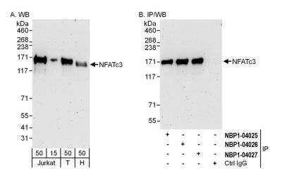 Western Blot: NFATC3/NFAT4 Antibody [NBP2-04027] - Detection of human NFATc3 by western blot and immunoprecipitation. Samples: Whole cell lysate from Jurkat (15 and 50 ug for WB; 1 mg for IP, 20% of IP loaded), HEK293T (T; 50 ug) and HeLa (H; 50 ug) cells. Antibodies: Affinity purified rabbit anti-NFATc3 antibody NBP2-04027 used for WB at 0.1 ug/ml (A) and 0.4 ug/ml (B) and used for IP at 6 ug/mg lysate. NFATc3 was also immunoprecipitated by rabbit anti-NFATc3 antibodies NBP2-04025 and NBP2-04026, which recognize upstream epitopes. Detection: Chemiluminescence with exposure times of 3 minutes (A and B).