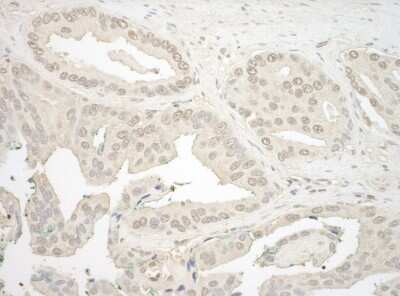 Immunohistochemistry-Paraffin NFATC4 Antibody