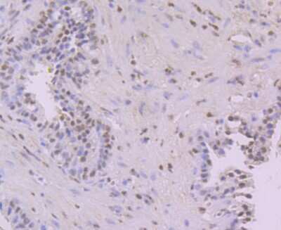Immunohistochemistry-Paraffin: NFIB Antibody (1H4) [NBP2-75590] - Analysis of paraffin-embedded human prostate tissue using anti-NFIB/NF1B2 antibody. Counter stained with hematoxylin.