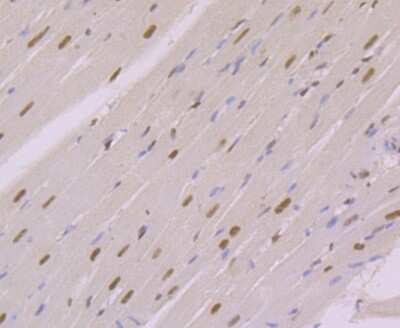 Immunohistochemistry-Paraffin: NFIB Antibody (1H4) [NBP2-75590] - Analysis of paraffin-embedded rat heart tissue using anti-NFIB/NF1B2 antibody. Counter stained with hematoxylin.