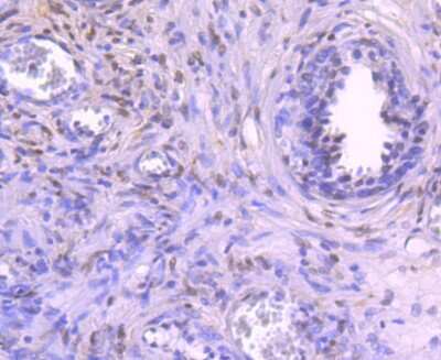 Immunohistochemistry-Paraffin: NFIB Antibody [NBP2-75588] - Analysis of paraffin-embedded human prostate tissue using anti-NFIB/NF1B2 antibody. Counter stained with hematoxylin.