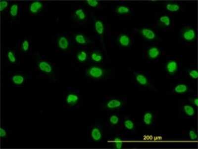 Immunocytochemistry/Immunofluorescence: NFIC Antibody (1D6) [H00004782-M03] - Analysis of monoclonal antibody to NFIC on HeLa cell. Antibody concentration 10 ug/ml