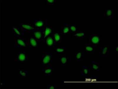 Immunocytochemistry/Immunofluorescence: NFIX Antibody [H00004784-B01P] - Analysis of purified antibody to NFIX on HeLa cell. (antibody concentration 10 ug/ml)