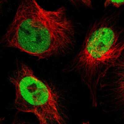 Immunocytochemistry/Immunofluorescence: NFIX Antibody [NBP2-58904] - Staining of human cell line U-251 MG shows localization to nucleoplasm. Antibody staining is shown in green.