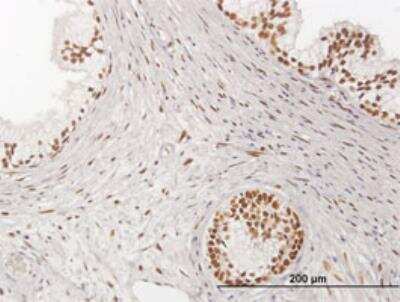 Immunohistochemistry-Paraffin: NFIX Antibody [H00004784-B01P] - Immunoperoxidase of purified MaxPab antibody to NFIX on formalin-fixed paraffin-embedded human prostate. [antibody concentration 3 ug/ml]