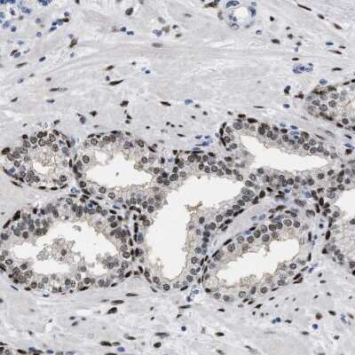 Immunohistochemistry-Paraffin: NFIX Antibody [NBP2-58904] - Staining of human prostate shows moderate to strong nuclear positivity in glandular cells.