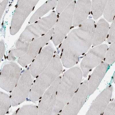 Immunohistochemistry-Paraffin: NFIX Antibody [NBP2-58904] - Staining of human skeletal muscle shows strong nuclear positivity in myocytes.