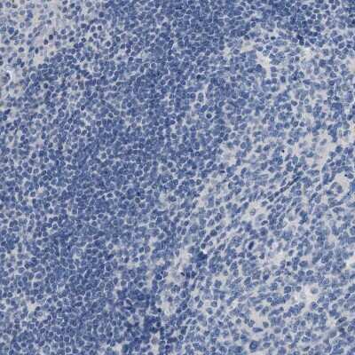 Immunohistochemistry-Paraffin: NFIX Antibody [NBP2-58904] - Staining of human tonsil shows no positivity in non-germinal center cells as expected.