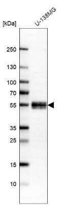 Western Blot NFIX Antibody