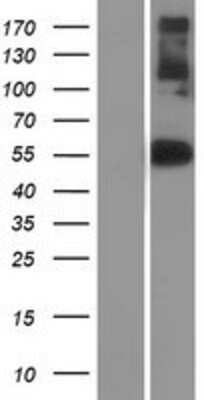 Western Blot NFIX Overexpression Lysate