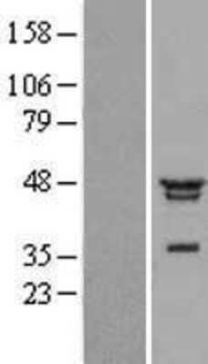 Western Blot: NFKBIL1 Overexpression Lysate (Adult Normal) [NBL1-13622] Left-Empty vector transfected control cell lysate (HEK293 cell lysate); Right -Over-expression Lysate for NFKBIL1.