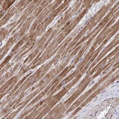 Immunohistochemistry: NFS1 Antibody [NBP2-37933] - Staining of human heart muscle shows moderate cytoplasmic positivity in myocytes.