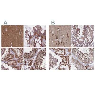 Immunohistochemistry-Paraffin: NFS1 Antibody [NBP2-38737] - Staining of human cerebral cortex, colon, kidney and testis using Anti-NFS1 antibody NBP2-38737 (A) shows similar protein distribution across tissues to independent antibody NBP2-37933 (B).