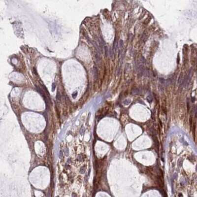 Immunohistochemistry-Paraffin: NFS1 Antibody [NBP2-38737] - Staining of human colon.