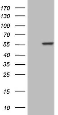 Western Blot: NFS1 Antibody (OTI2H5) - Azide and BSA Free [NBP2-72978] - Analysis of HEK293T cells were transfected with the pCMV6-ENTRY control (Left lane) or pCMV6-ENTRY NFS1.