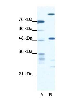 Western Blot: NFS1 Antibody [NBP1-54685] - Jurkat cell lysate, concentration 0.3125ug/ml.