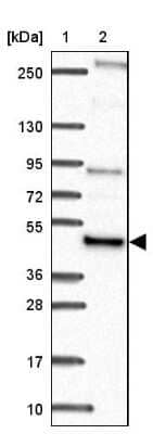 <b>Independent Antibodies Validation. </b>Western Blot: NFS1 Antibody [NBP2-38737] - Lane 1: Marker  [kDa] 250, 130, 95, 72, 55, 36, 28, 17, 10.  Lane 2: Human cell line RT-4