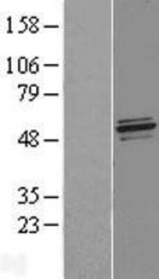 Western Blot: NFS1 Overexpression Lysate (Adult Normal) [NBL1-13625] Left-Empty vector transfected control cell lysate (HEK293 cell lysate); Right -Over-expression Lysate for NFS1.