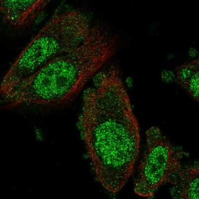 Immunocytochemistry/Immunofluorescence: NFX1 Antibody [NBP2-57148] - Staining of human cell line PC-3 shows localization to nucleus & cytosol.