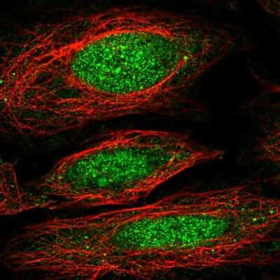 Immunocytochemistry/Immunofluorescence: NFX1 Antibody [NBP2-58058] - Staining of human cell line SiHa shows localization to nucleus & cytosol.