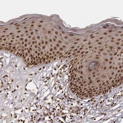 Immunohistochemistry-Paraffin: NFX1 Antibody [NBP2-57963] - Immunohistochemical staining of human skin shows shows strong nuclear positivity in epidermal cells.