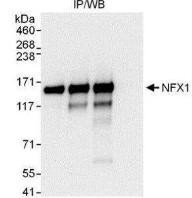 Immunoprecipitation: NFX1 Antibody [NBP1-49932] - Detection of Human NFX1 by Western Blot of Immunoprecipitates.  Samples:  Whole cell lysate (1 mg for IP, 20% of IP loaded) from HeLa cells.  Antibodies: Affinity purified rabbit anti-NFX1 antibody used for IP at 3 mcg/mg lysate.  NFX1 was also immunoprecipitated by rabbit anti-NFX1 antibodies which recognize other epitopes.  For blotting immunoprecipitated NFX1 was used at 0.4 mcg/ml.   Detection: Chemiluminescence with an exposure time of 10 seconds.