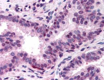 Immunohistochemistry: NFYA Antibody [NB600-481] - Tissue: human prostate tissue. Fixation: formalin fixed paraffin embedded. Antigen retrieval: not required. Primary antibody: NF-Y antibody at 10ug/mL for 1 h at RT. Secondary antibody: Peroxidase rabbit secondary antibody at 1:10,000 for 45 min at RT. Localization: NF-Y is nuclear. Staining: NF-Y subunit A as precipitated red signal with hematoxylin purple nuclear counterstain.