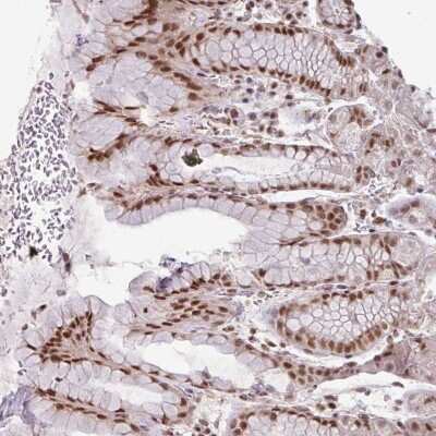 Immunohistochemistry-Paraffin: NFYA Antibody [NBP2-48977] - Staining of human stomach, lower shows strong nuclear positivity in glandular cells.