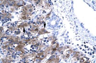 Immunohistochemistry: NFYA Antibody [NBP2-87907] - Human Liver