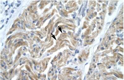 Immunohistochemistry: NFYA Antibody [NBP2-87908] - HumanMuscle