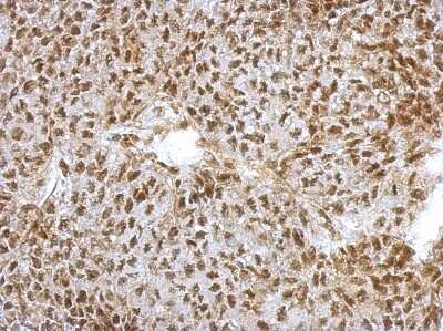 Immunohistochemistry-Paraffin: NFYA Antibody [NBP2-19533] - Immunohistochemical analysis of paraffin-embedded D54 xenograft, using antibody at 1:500 dilution.